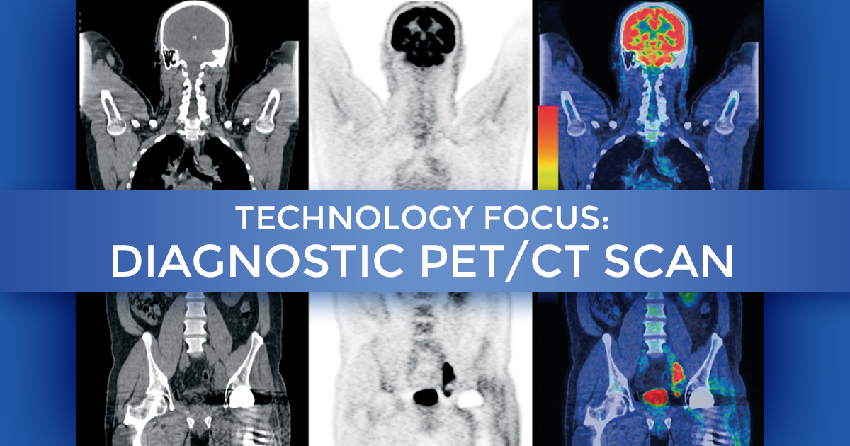 Technology Focus – Diagnostic PET/CT Scan at Summit Cancer